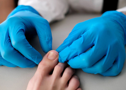 Nail fungus: do home remedies work or not?